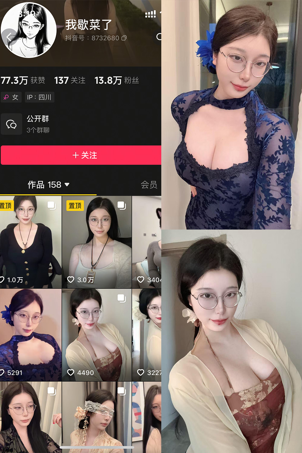 【在线看】抖音 我歇菜了 微密圈 NO.001期 【10P】免费-写真-微密圈-铁粉空间-铁粉花园SCity写真网